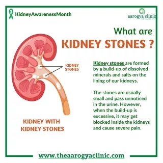 What are Kidney Stones | Homeopathy treatment for Kidney stone without surgery in Vellore, India | aarogya clinic