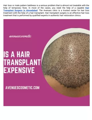 Is A Hair Transplant Expensive