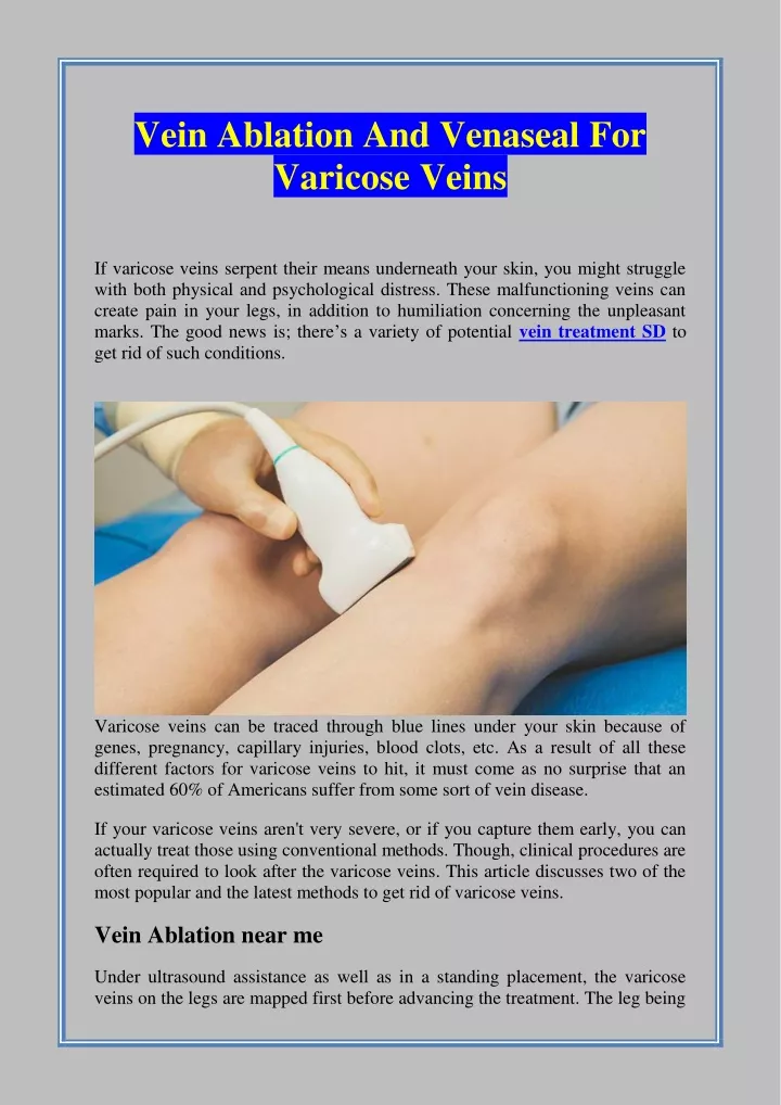 vein ablation and venaseal for varicose veins