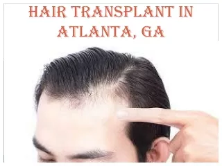 HAIR TRANSPLANT IN ATLANTA, GA