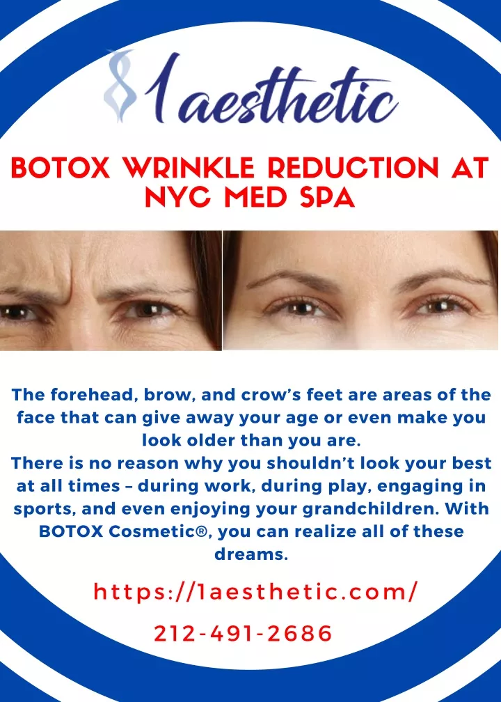 botox wrinkle reduction at nyc med spa