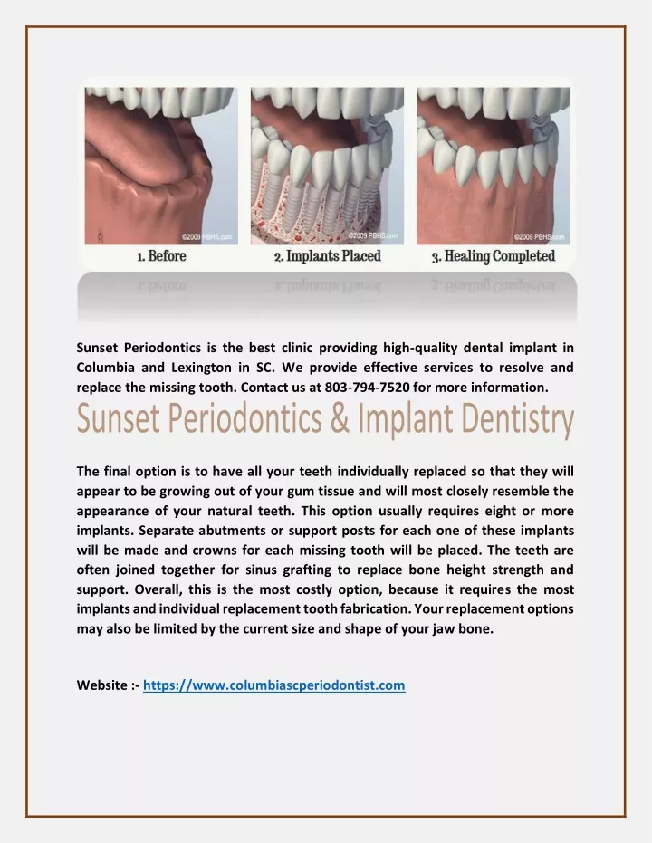 sunset periodontics is the best clinic providing