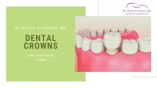Dental crowns Provider in Lake Forest California | Dr. Daisy P. Alvarenga. DDS