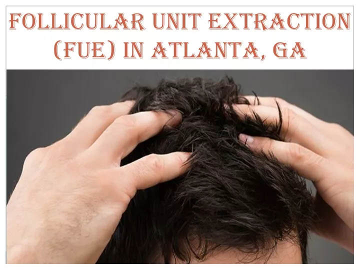 follicular unit extraction fue in atlanta ga