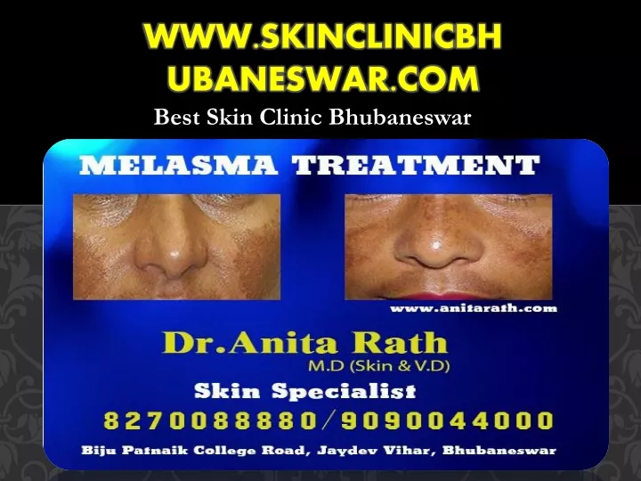 www skinclinicbhubaneswar com