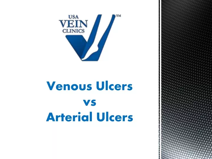 venous ulcers vs arterial ulcers
