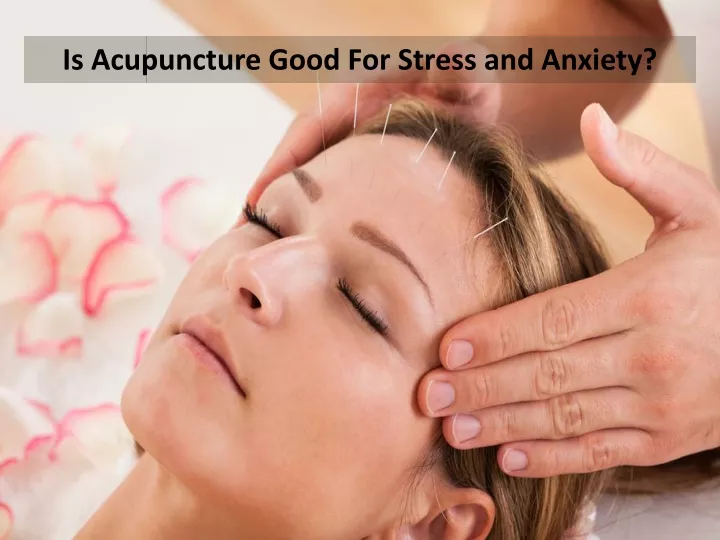 is acupuncture good for stress and anxiety