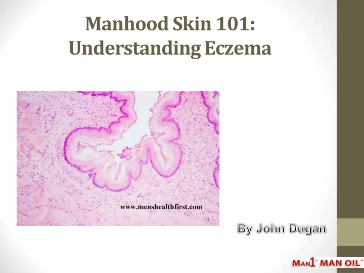 manhood skin 101 understanding eczema