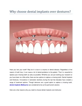 Why choose dental implants over dentures?