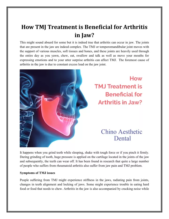 how tmj treatment is beneficial for arthritis