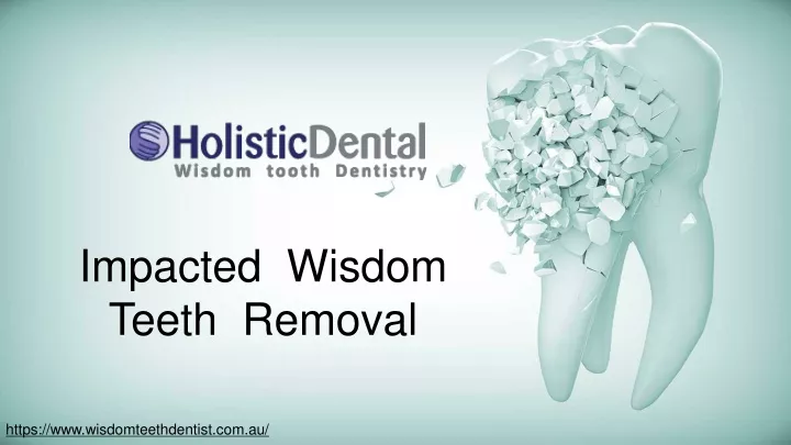 impacted wisdom teeth removal