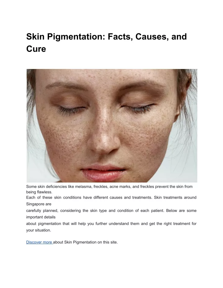 skin pigmentation facts causes and cure