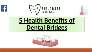 5 Health Benefits of Dental Bridges