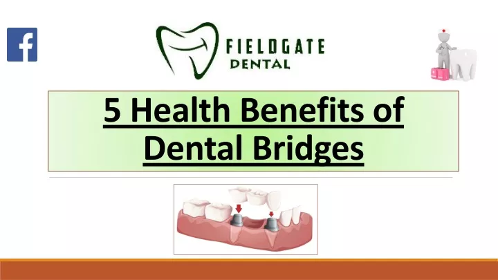 5 health benefits of dental bridges