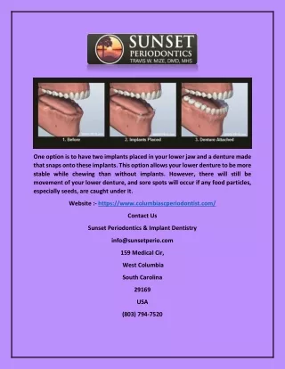one option is to have two implants placed in your