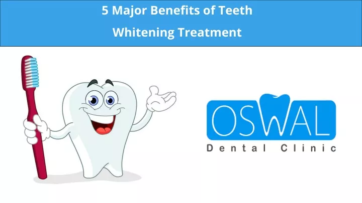 5 major benefits of teeth whitening treatment