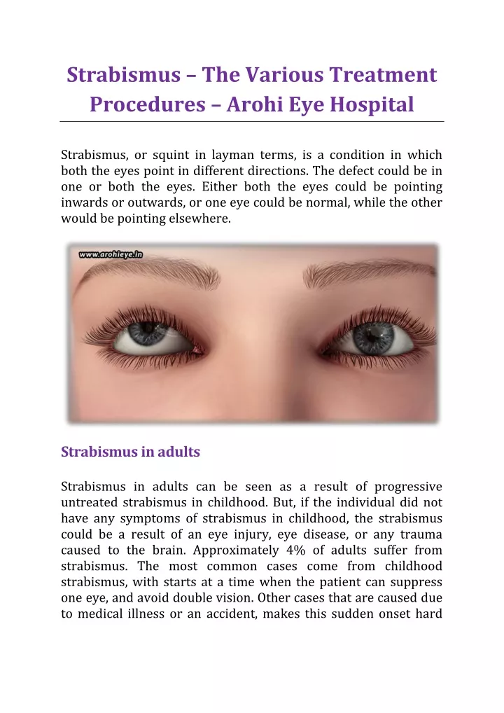 strabismus the various treatment procedures arohi