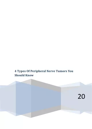 4 types of peripheral nerve tumors you should know