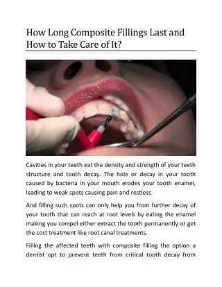 How Long Composite Fillings Last and Take Care of It?