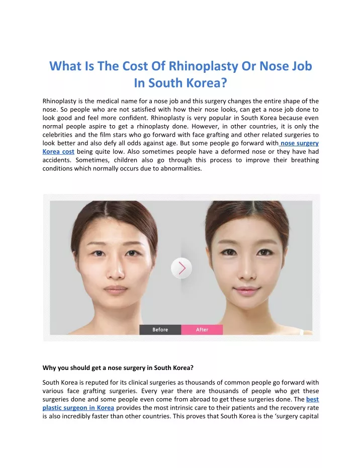 what is the cost of rhinoplasty or nose
