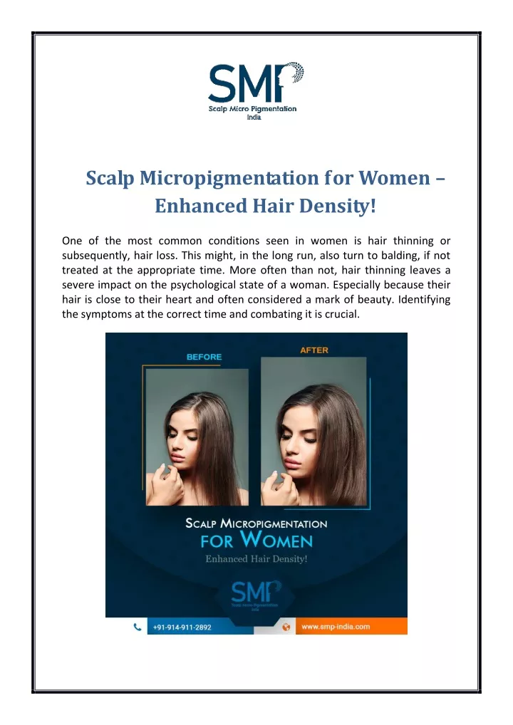 scalp micropigmentation for women enhanced hair