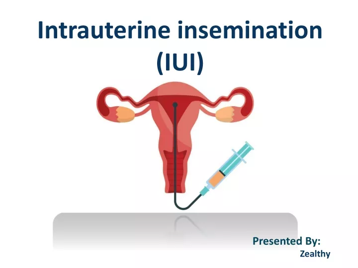 intrauterine insemination iui