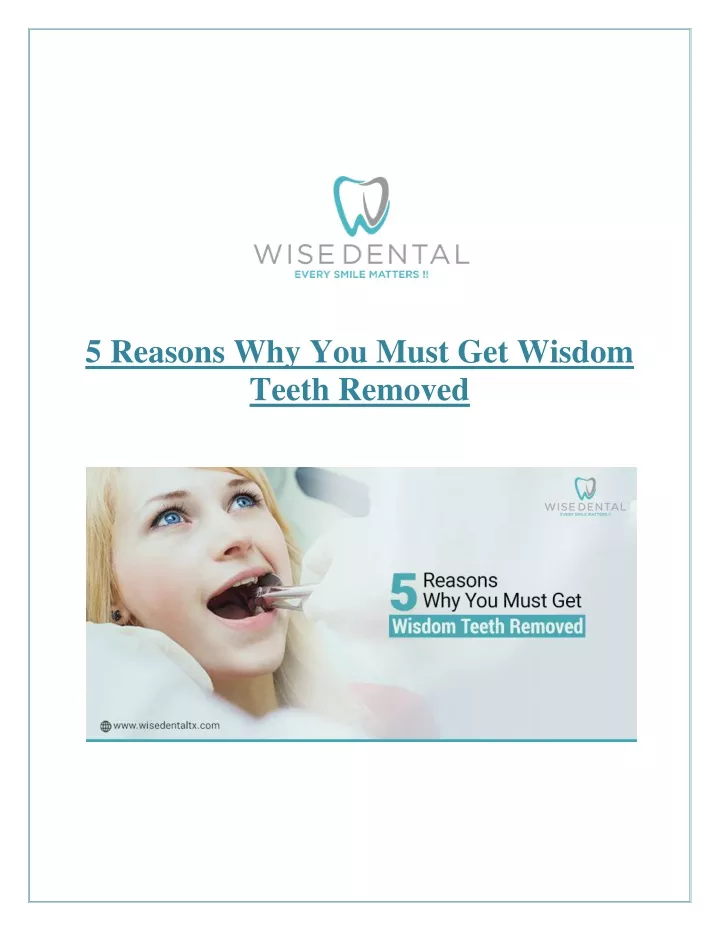 5 reasons why you must get wisdom teeth removed
