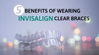5 Benefits Of Wearing Invisalign Clear Braces