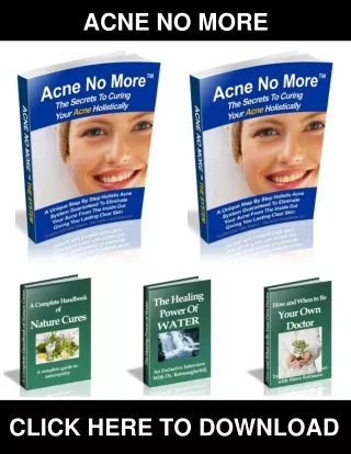 Acne No More PDF, eBook by Mike Walden‎