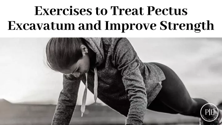 exercises to treat pectus excavatum and improve