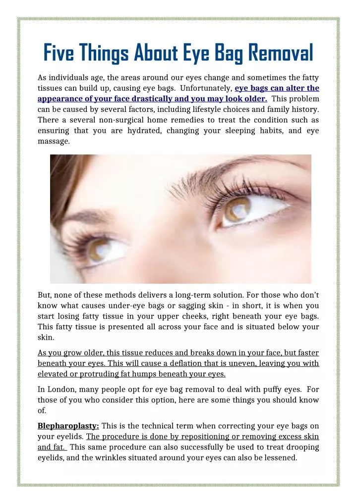 five things about eye bag removal