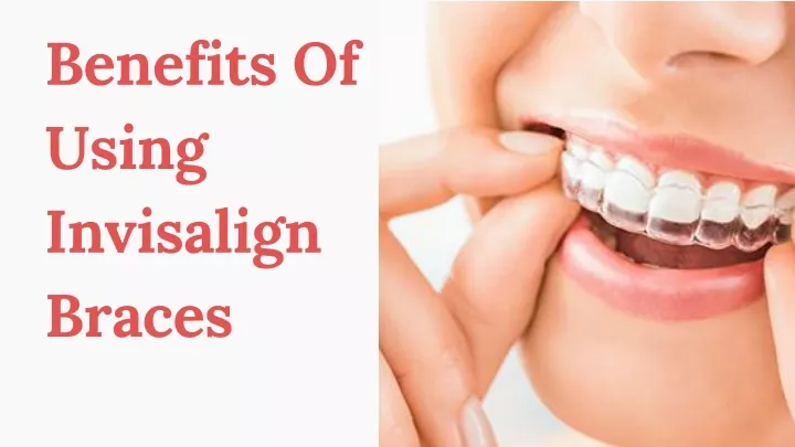 benefits of using invisalign braces