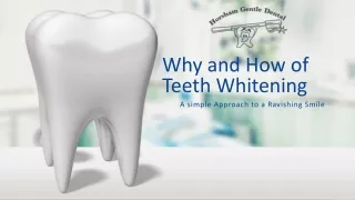Why and How of Teeth Whitening: A simple Approach to a Ravishing Smile