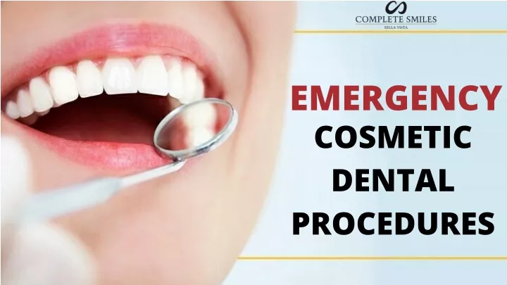 emergency cosmetic dental procedures