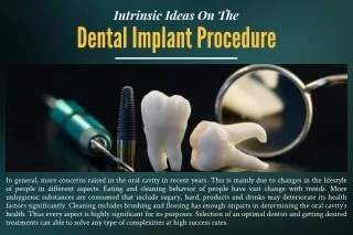 Intrinsic Ideas On The Dental Implant Procedure