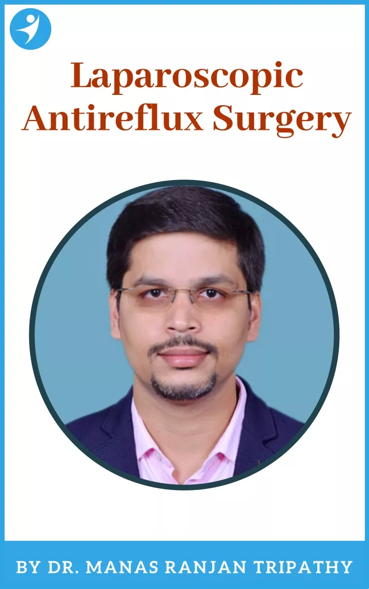 laparoscopic antireflux surgery