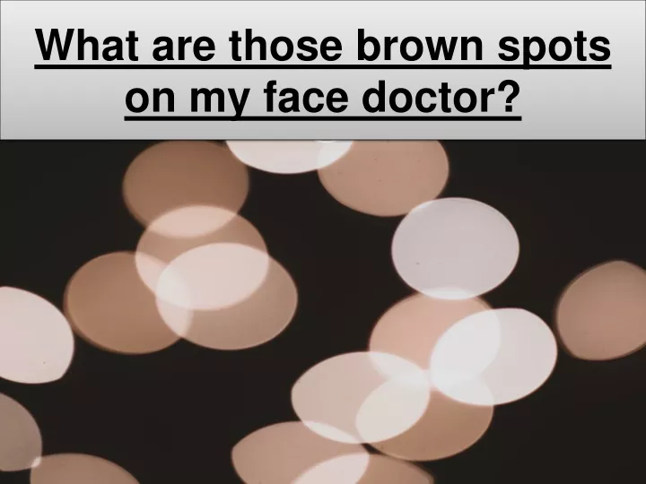 what are those brown spots on my face doctor