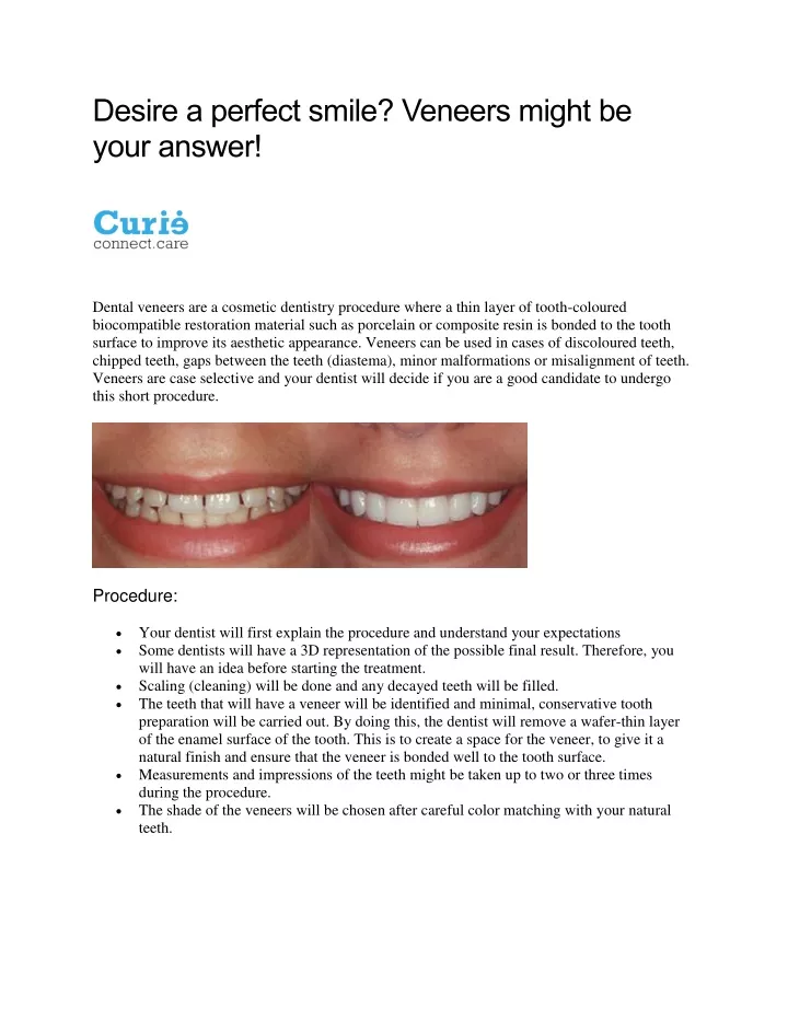 desire a perfect smile veneers might be your