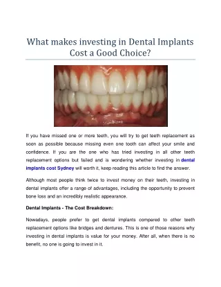 What makes investing in Dental Implants Cost a Good Choice?