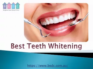 best teeth whitening
