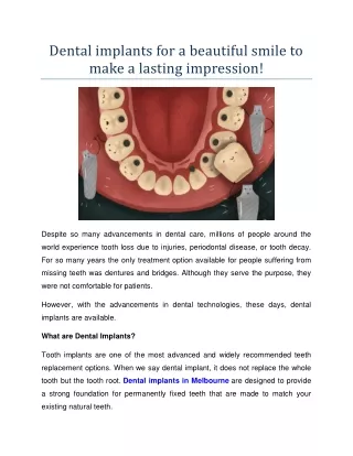 Dental implants for a beautiful smile to make a lasting impression!