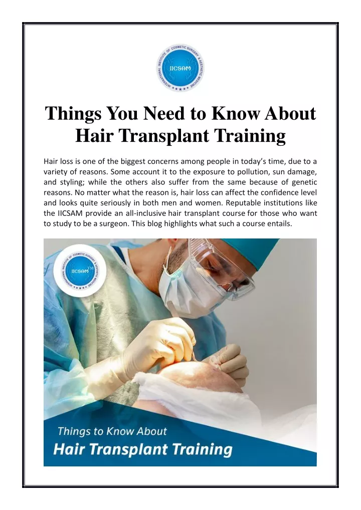 things you need to know about hair transplant