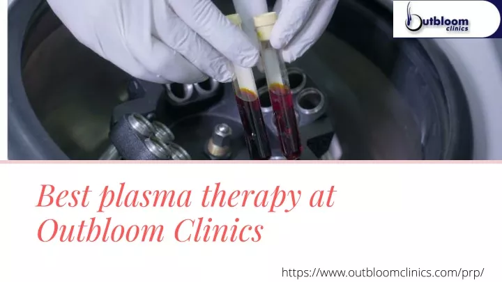 best plasma therapy at outbloom clinics