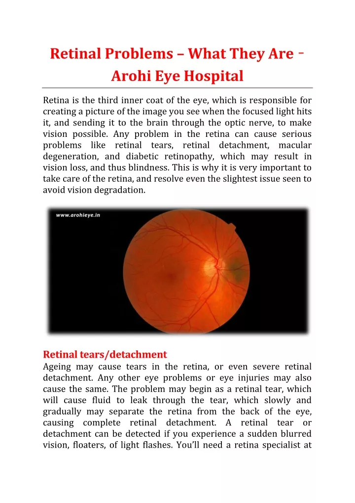 retinal problems what they are arohi eye hospital