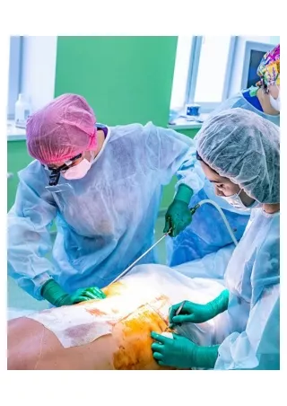 Liposuction Surgery