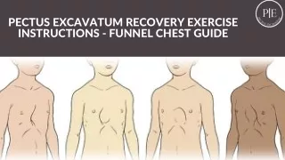 Pectus Excavatum Exercises - Funnel Chest Guide