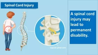 A spinal cord injury may lead to permanent disability.