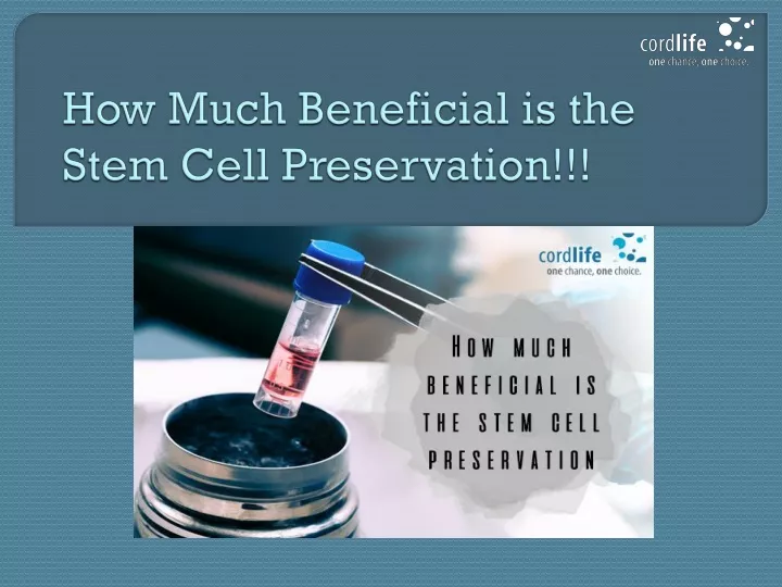 how much beneficial is the stem cell preservation