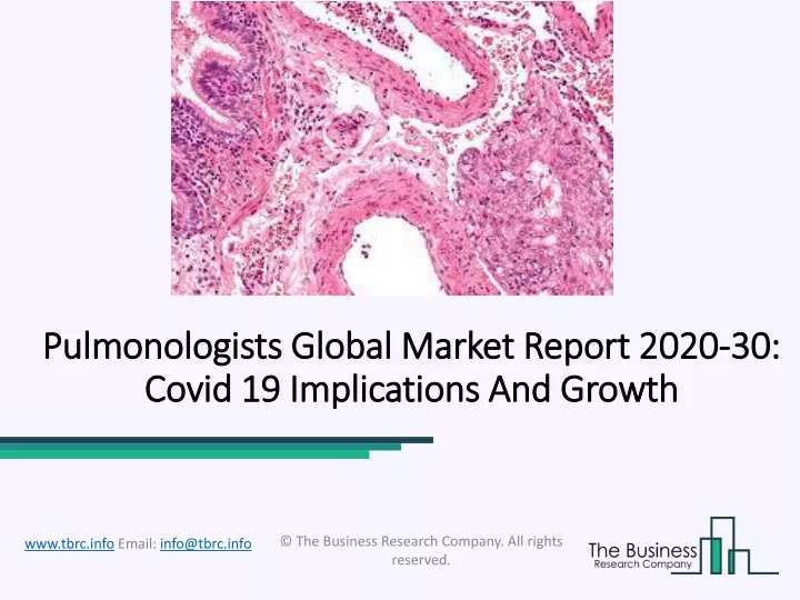 pulmonologists global market report 2020