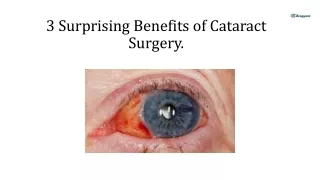 3 Surprising Benefits of Cataract Surgery.